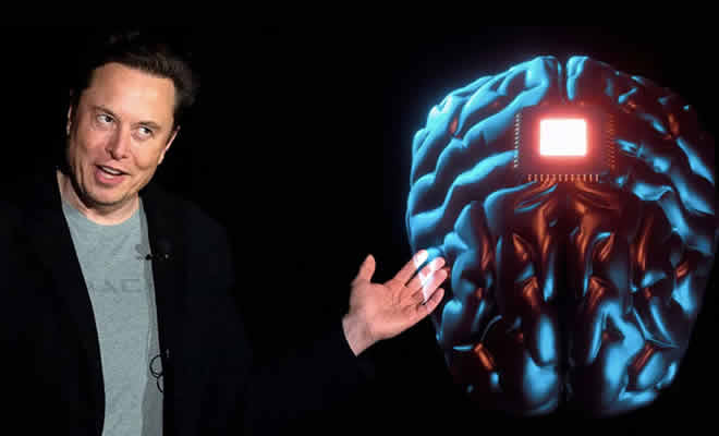 Ελον Μασκ: Ανακοίνωσε την πρώτη εμφύτευση τσιπ στον ανθρώπινο εγκέφαλο
